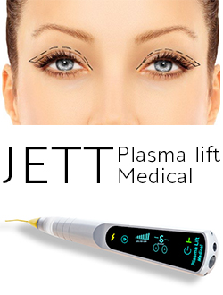 Imagine Blefaroplastia nechirurgicala cu Jett Plasma Lift Medical